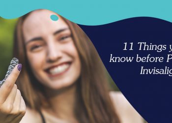 Invisalign process