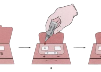 fecal occult blood test