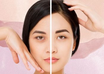 appearance of dark circles