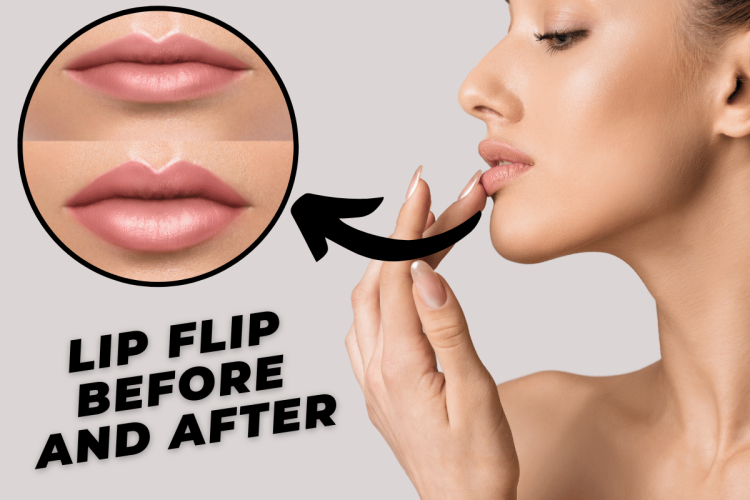 lip flip before and after